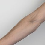 What are Track Marks