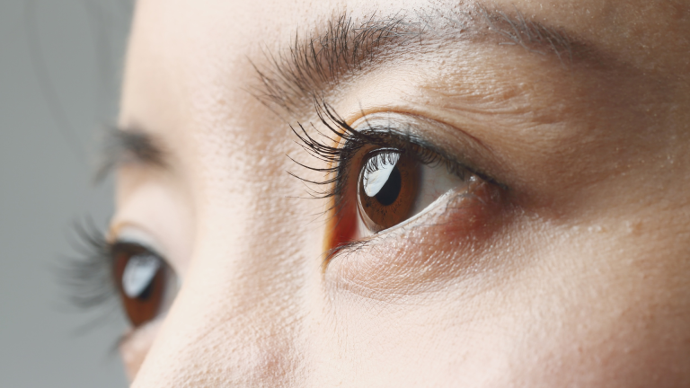 high eyes