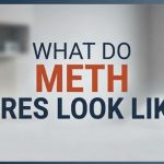 What Do Meth Sores Look Like
